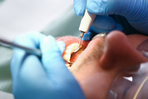 Best Dentist for Tooth Abscess  in Mission, KS